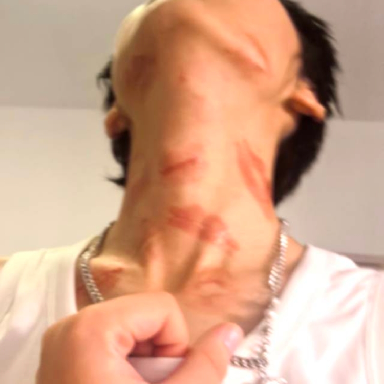 ***